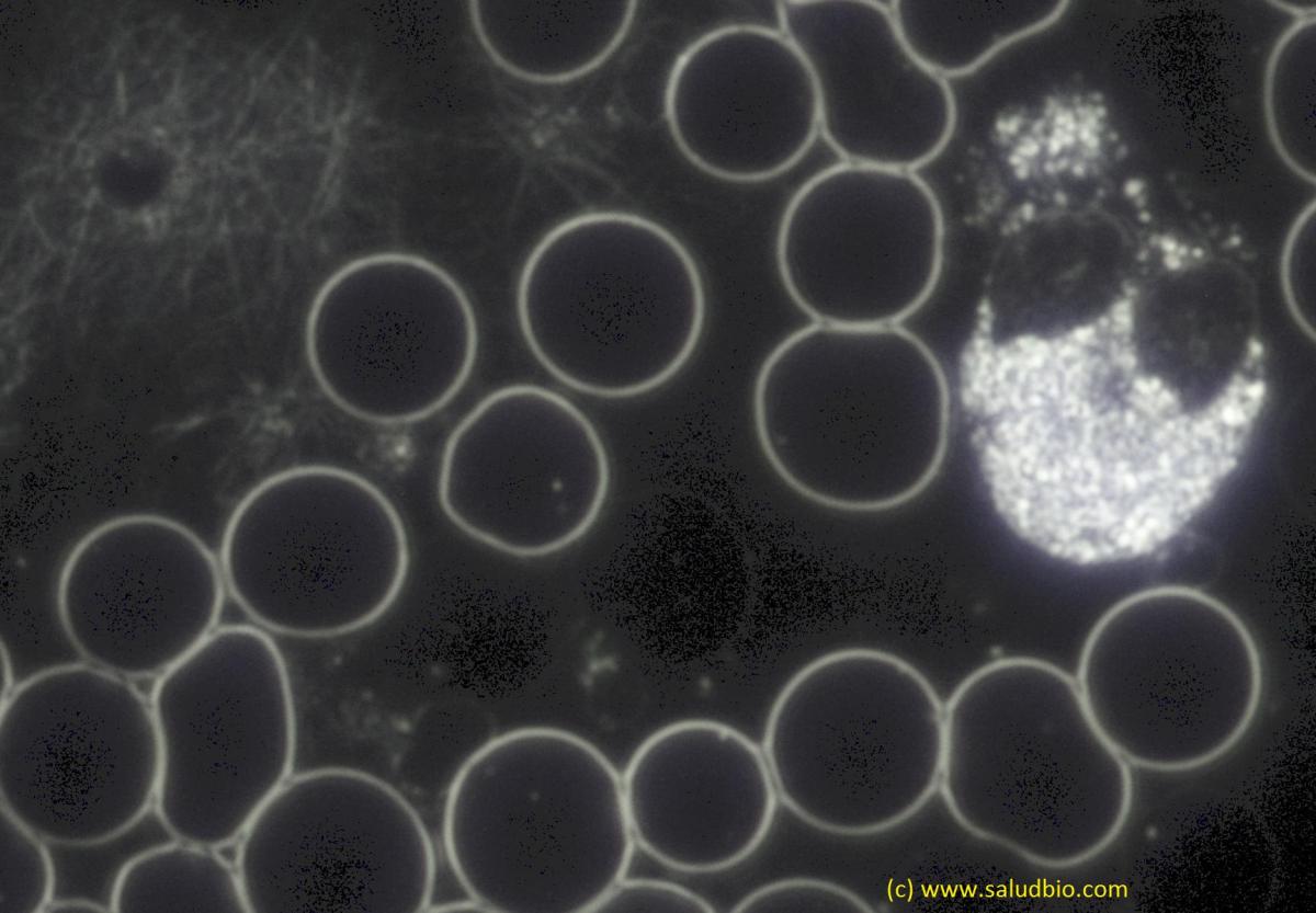 Glóbulo blanco en microscopio de campo oscuro