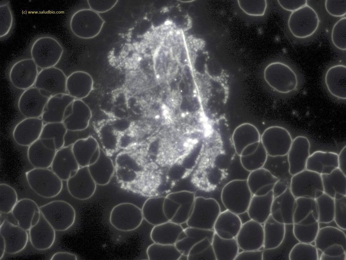 Leucocitos con microscopio de campo oscuro