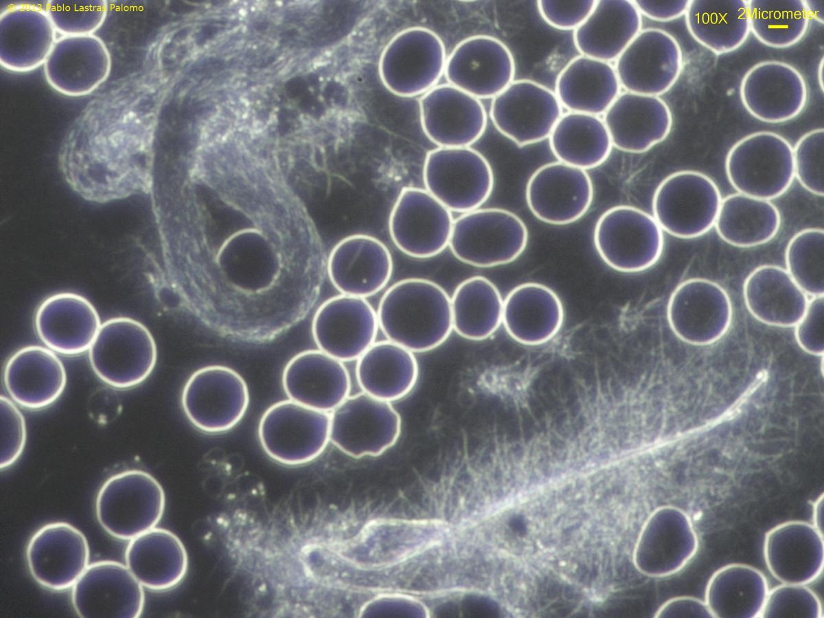 Fibrina en madejas con microscopio de campo oscuro