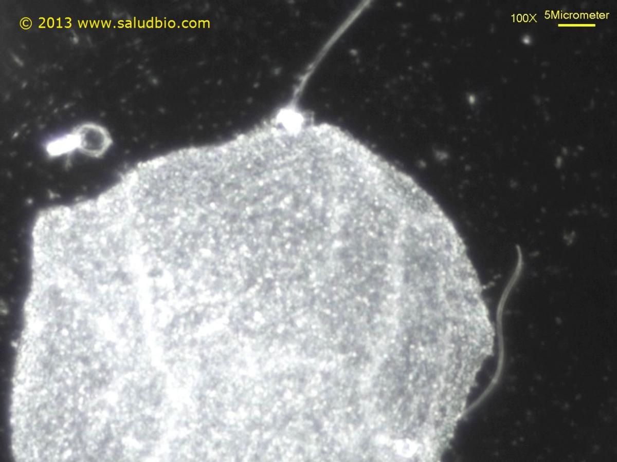 Espermatozoides en microscopio de campo oscuro