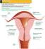 Endometrio Endometrio