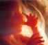 Causas y Síntomas del aborto Causas y Síntomas del aborto