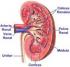 Causas y síntomas de hematuria