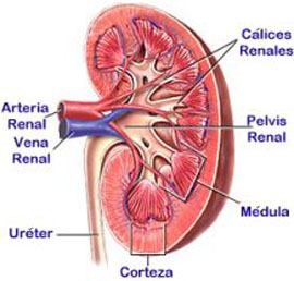 Homeopatía para los cálculos renales