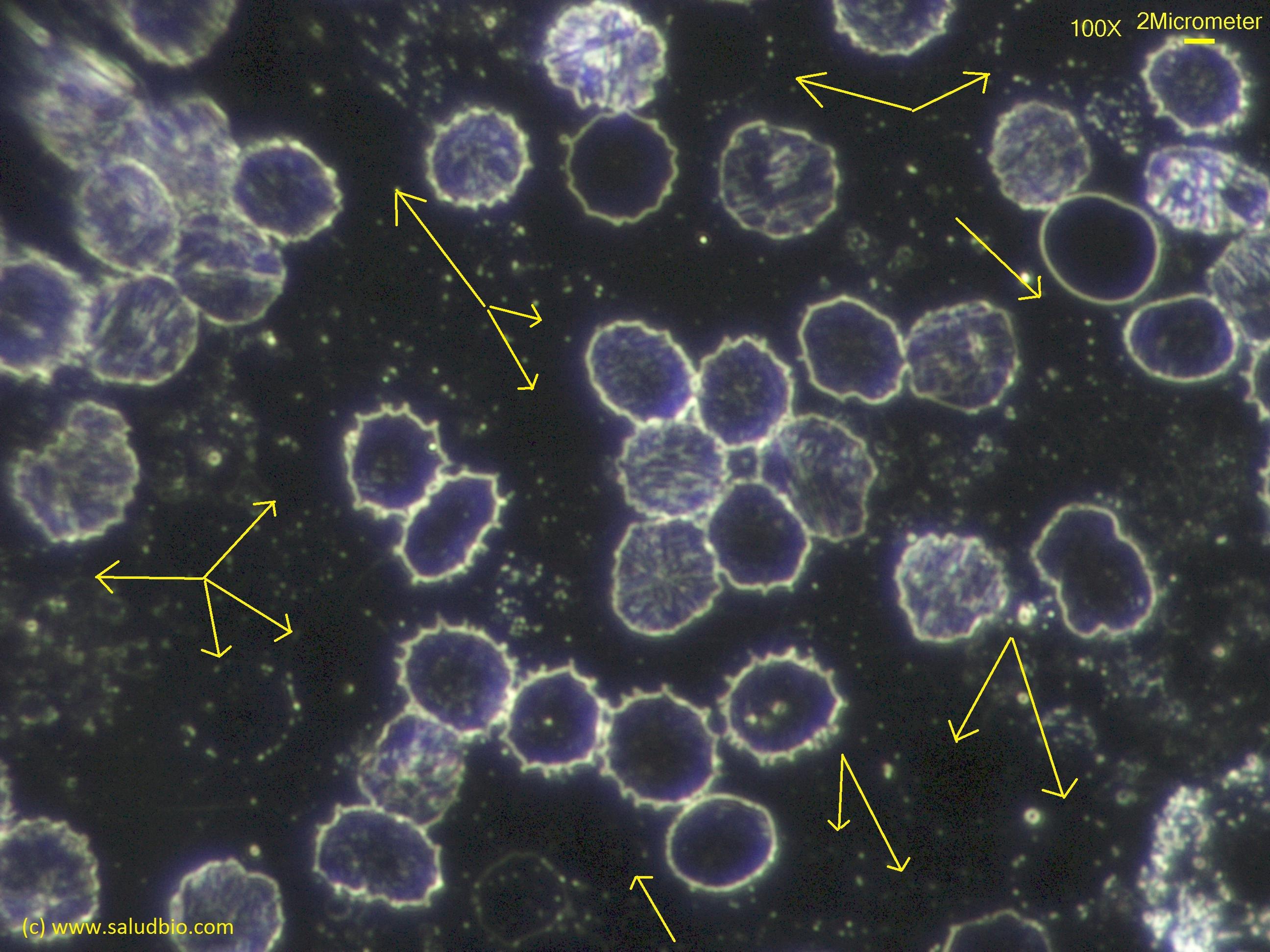 Eritrocitos fantasma con microscopio de campo oscuro