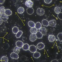 Eritrocitos fantasma con microscopio de campo oscuro