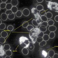 Leucocitos y glóbulos rojos con microscopio de campo oscuro