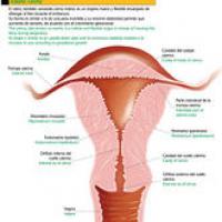 Relación entre endometriosis y cáncer