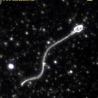 Espermatozoide con microscopio de campo oscuro (1000X)