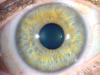 Medicina natural para los ojos