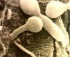 Candidiasis - Causas