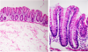 Vellosidades intestinales para la absorción