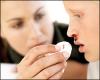 Medicina natural para las hemorragias nasales