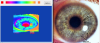 Iris digitalizado