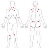 Medicina natural para la fibromialgia