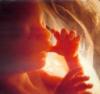 Causas y síntomas de un aborto