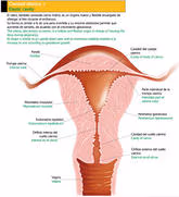 Relación entre endometriosis y cáncer