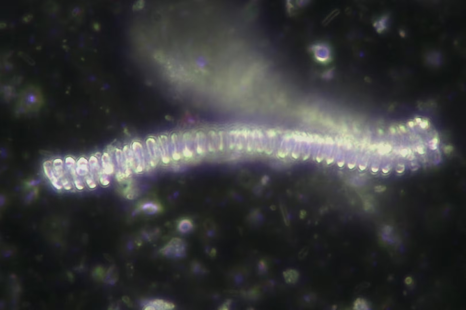 Parásitos intestinales