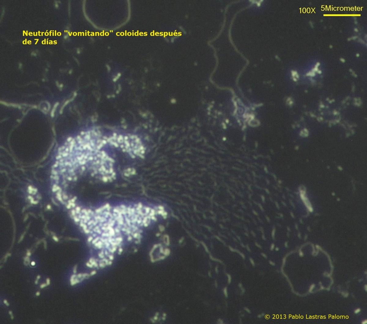 Nuetrófilo descomposición en microscopio de campo oscuro