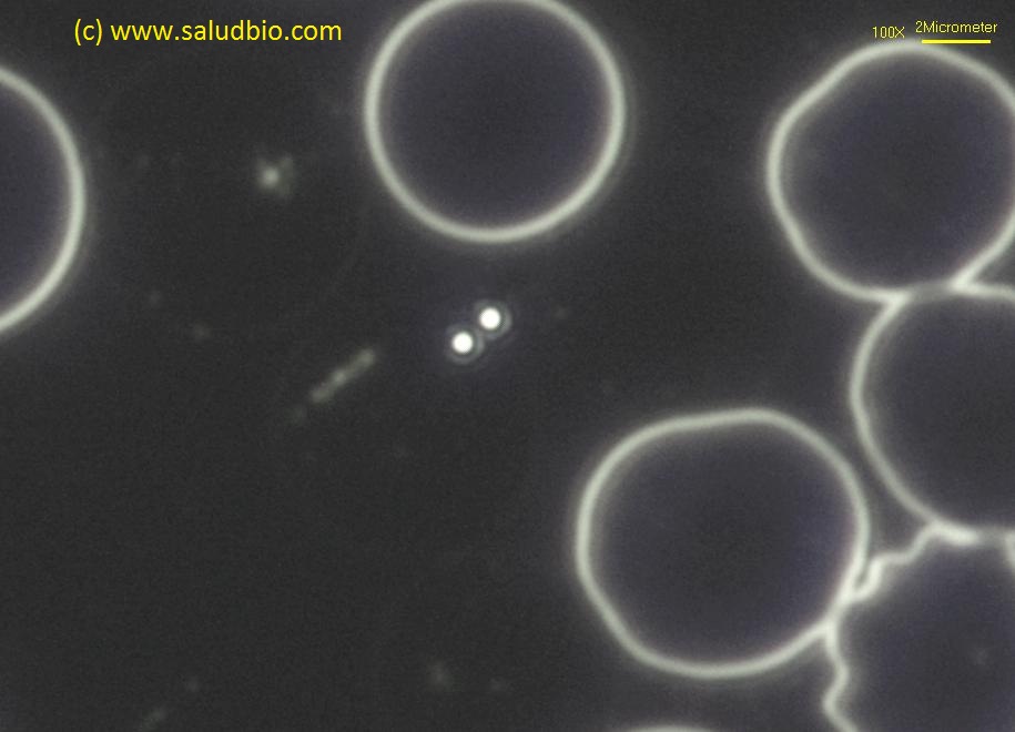 Eritrocitos y simprotitos con microscopio de campo oscuro