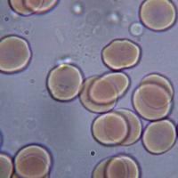 Sangre en microscopio