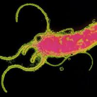 Tratamientos naturales para la infección por Helicobacter pylori