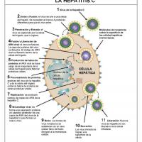 Síntomas de hepatitis