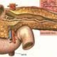 Omega 3 y la diabetes