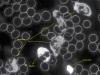 Células sanguíneas con microscopio de campo oscuro