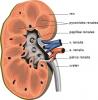Síntomas del cólico al riñón